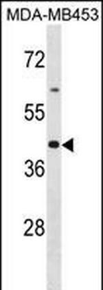 OR2B6 Polyclonal Antibody