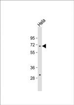 TAF1B Polyclonal Antibody