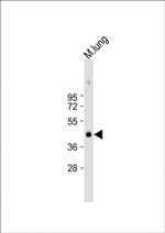 Urokinase Polyclonal Antibody