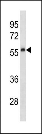 Urokinase Antibody in Western Blot (WB)