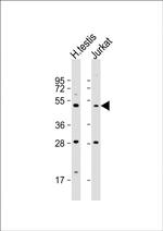 OXCT2 Polyclonal Antibody