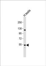 GOLGA6L2 Polyclonal Antibody