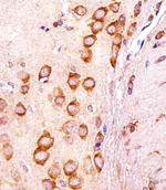 CGREF1 Polyclonal Antibody