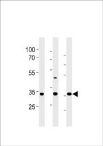 CGREF1 Antibody in Western Blot (WB)