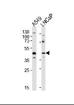 GGN Polyclonal Antibody