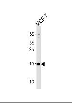 POLR2J3 Polyclonal Antibody