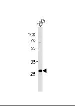 PRB4 Polyclonal Antibody