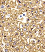 HBG2 Polyclonal Antibody