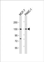 MORC2 Antibody in Western Blot (WB)