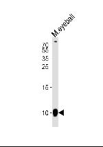 GNGT1 Polyclonal Antibody