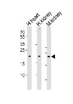 CYS1 Antibody in Western Blot (WB)