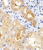 MAD2L2 Antibody in Immunohistochemistry (Paraffin) (IHC (P))
