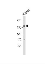 OVOS1 Antibody in Western Blot (WB)