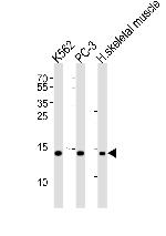 HIST1H2BM Polyclonal Antibody