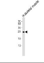 TMEM239 Antibody in Western Blot (WB)