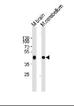 ZDHHC14 Polyclonal Antibody