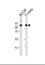 ESRG Polyclonal Antibody