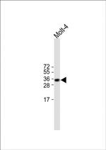 TRBC1 Antibody in Western Blot (WB)
