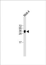 TRBC1 Polyclonal Antibody