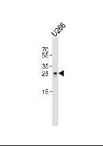 TRBC1 Antibody in Western Blot (WB)