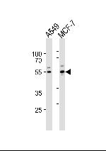 PPP2R2C Polyclonal Antibody