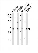 PCGF1 Polyclonal Antibody