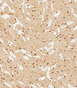 WDR82 Polyclonal Antibody