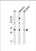 WDR82 Antibody in Western Blot (WB)