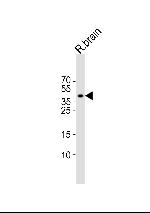 ISL1 Polyclonal Antibody