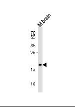 FAM168B Antibody in Western Blot (WB)
