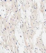 EHD2 Antibody in Immunohistochemistry (Paraffin) (IHC (P))