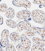 EHD2 Polyclonal Antibody