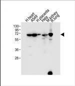 EHD2 Antibody in Western Blot (WB)