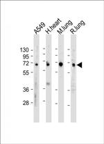 EHD2 Antibody in Western Blot (WB)
