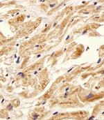 ITGB8 Polyclonal Antibody