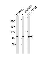 ITGB8 Antibody in Western Blot (WB)