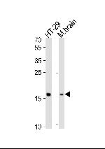 TMEM160 Antibody in Western Blot (WB)