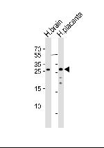 CHMP4A Polyclonal Antibody