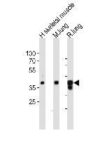 LMCD1 Polyclonal Antibody