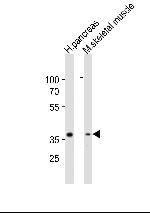 B4GALT7 Polyclonal Antibody