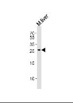 Noto Antibody in Western Blot (WB)
