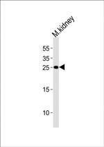 Claudin 6 Antibody in Western Blot (WB)