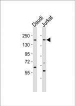 BZRAP1 Polyclonal Antibody
