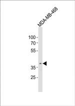 OR5A1 Polyclonal Antibody