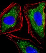 ITGA7 Polyclonal Antibody