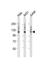 ITGA7 Antibody in Western Blot (WB)