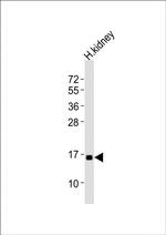 NFE4 Polyclonal Antibody