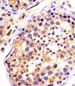 DYNC1H1 Polyclonal Antibody