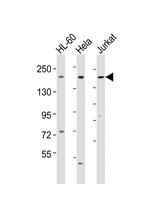 DIP2A Polyclonal Antibody