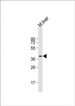 AKR7L Antibody in Western Blot (WB)